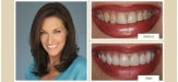 smile-gallery